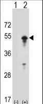 STAM1 / STAM Antibody - Western blot of STAM (arrow) using rabbit polyclonal STAM Antibody (D10). 293 cell lysates (2 ug/lane) either nontransfected (Lane 1) or transiently transfected (Lane 2) with the STAM gene.