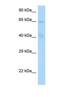 STAM1 / STAM Antibody - STAM antibody Western blot of HeLa Cell lysate. Antibody concentration 1 ug/ml.  This image was taken for the unconjugated form of this product. Other forms have not been tested.