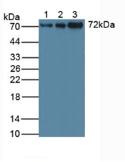 STAM1 / STAM Antibody - Western Blot; Sample: Lane1: Human Jurkat Cells; Lane2: Human PC-3 Cells; Lane3: Human Raji Cells.