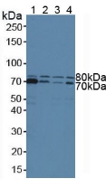 STAM1 / STAM Antibody - Western Blot; Sample: Lane1: Human Hela Cells; Lane2: Human Raji Cells; Lane3: Human Jurkat Cells; Lane4: Human K562 Cells.