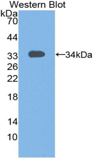 STAM1 / STAM Antibody - Western blot of recombinant STAM1 / STAM.