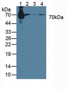 STAM1 / STAM Antibody - Western Blot; Sample: Lane1: Rat Serum; Lane2: Human Raji cells; Lane3: Human Jurkat cells; Lane4: Human K562 cells.