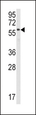 STAM1 / STAM Antibody - Western blot of anti-STAM Antibody in HeLa cell line lysates (35 ug/lane). STAM (arrow) was detected using the purified antibody.