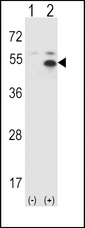 STAM1 / STAM Antibody - Western blot of STAM (arrow) using rabbit polyclonal STAM Antibody (P341). 293 cell lysates (2 ug/lane) either nontransfected (Lane 1) or transiently transfected (Lane 2) with the STAM gene.