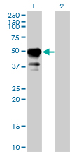 STAM1 / STAM Antibody - Western blot of STAM expression in transfected 293T cell line by STAM monoclonal antibody (M01), clone 2B11-1G1.