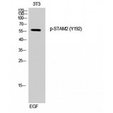 STAM2 Antibody - Western blot of Phospho-STAM2 (Y192) antibody