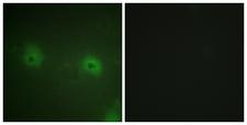 STAM2 Antibody - Immunofluorescence analysis of HUVEC cells, using STAM2 Antibody. The picture on the right is blocked with the synthesized peptide.