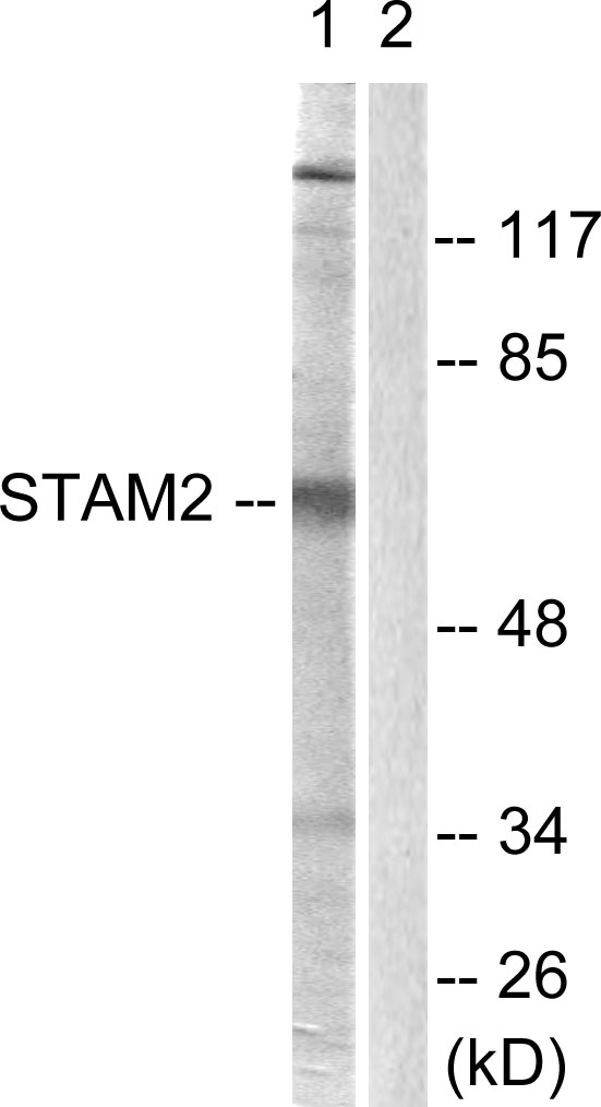 STAM2 Antibody - Western blot analysis of lysates from NIH/3T3 cells, treated with EGF 200ng/ml 30', using STAM2 Antibody. The lane on the right is blocked with the synthesized peptide.