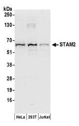 STAM2 Antibody - Detection of human STAM2 by western blot. Samples: Whole cell lysate (50 µg) from HeLa, HEK293T, and Jurkat cells prepared using NETN lysis buffer. Antibody: Affinity purified rabbit anti-STAM2 antibody used for WB at 0.1 µg/ml. Detection: Chemiluminescence with an exposure time of 30 seconds.