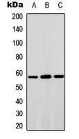 STAM2 Antibody - Western blot analysis of STAM2 expression in HepG2 (A); HeLa (B); NIH3T3 (C) whole cell lysates.
