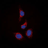 STAM2 Antibody - Immunofluorescent analysis of STAM2 staining in HepG2 cells. Formalin-fixed cells were permeabilized with 0.1% Triton X-100 in TBS for 5-10 minutes and blocked with 3% BSA-PBS for 30 minutes at room temperature. Cells were probed with the primary antibody in 3% BSA-PBS and incubated overnight at 4 deg C in a humidified chamber. Cells were washed with PBST and incubated with a DyLight 594-conjugated secondary antibody (red) in PBS at room temperature in the dark. DAPI was used to stain the cell nuclei (blue).