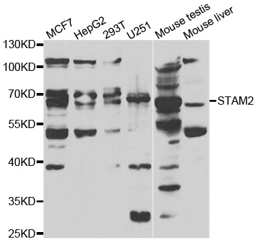STAM2 Antibody - Western blot analysis of extracts of various cell lines.