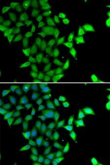 STAM2 Antibody - Immunofluorescence analysis of U20S cells.