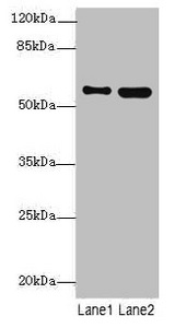 STAM2 Antibody - Western blot All Lanes: STAM2antibody at 4.09ug/ml Lane 1 : 293T whole cell lysate Lane 2 : Hela whole cell lysate Secondary Goat polyclonal to Rabbit IgG at 1/10000 dilution Predicted band size: 59,39 kDa Observed band size: 58 kDa