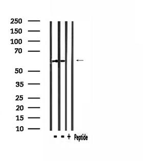 STAM2 Antibody - Western blot analysis of extracts of mouse brain and mouse spleen using STAM2 antibody.