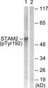 STAM2 Antibody - Western blot analysis of lysates from NIH/3T3 cells treated with EGF 200ng/ml 30', using STAM2 (Phospho-Tyr192) Antibody. The lane on the right is blocked with the phospho peptide.