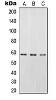 STAM2 Antibody - Western blot analysis of STAM2 (pY192) expression in HEK293T EGF-treated (A); SP2/0 EGF-treated (B); rat spleen (C) whole cell lysates.