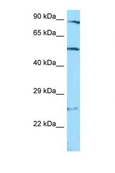 STAMBP / AMSH Antibody - STAMBP antibody Western blot of Jurkat Cell lysate. Antibody concentration 1 ug/ml.  This image was taken for the unconjugated form of this product. Other forms have not been tested.