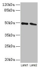 STAMBP / AMSH Antibody - Western blot All lanes: STAM-binding protein antibody at 12µg/ml Lane 1: Jurkat whole cell lysate Lane 2: Hela whole cell lysate Secondary Goat polyclonal to rabbit IgG at 1/10000 dilution Predicted band size: 49, 40 kDa Observed band size: 49 kDa