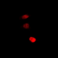 STAMBP / AMSH Antibody - Immunofluorescent analysis of STAMBP staining in U2OS cells. Formalin-fixed cells were permeabilized with 0.1% Triton X-100 in TBS for 5-10 minutes and blocked with 3% BSA-PBS for 30 minutes at room temperature. Cells were probed with the primary antibody in 3% BSA-PBS and incubated overnight at 4 deg C in a humidified chamber. Cells were washed with PBST and incubated with a DyLight 594-conjugated secondary antibody (red) in PBS at room temperature in the dark.