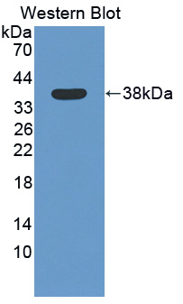 STAP1 / BRDG1 Antibody - Western blot of STAP1 / BRDG1 antibody.