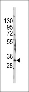 STAP1 / BRDG1 Antibody - Western blot of anti-STAP1 Antibody (F56) in mouse kidney tissue lysates (35 ug/lane). STAP(arrow) was detected using the purified antibody.