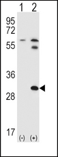 STAP1 / BRDG1 Antibody - Western blot of STAP1 (arrow) using rabbit polyclonal STAP1 Antibody (F56). 293 cell lysates (2 ug/lane) either nontransfected (Lane 1) or transiently transfected (Lane 2) with the STAP1 gene.