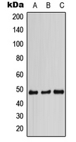 STAP2 Antibody - Western blot analysis of STAP2 expression in HCT116 (A); SP2/0 (B); PC12 (C) whole cell lysates.