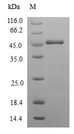 ACPP / PAP Protein - (Tris-Glycine gel) Discontinuous SDS-PAGE (reduced) with 5% enrichment gel and 15% separation gel.