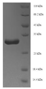 acpS Protein - (Tris-Glycine gel) Discontinuous SDS-PAGE (reduced) with 5% enrichment gel and 15% separation gel.