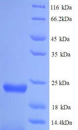 def / Peptide deformylase Protein