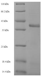 fabI Protein - (Tris-Glycine gel) Discontinuous SDS-PAGE (reduced) with 5% enrichment gel and 15% separation gel.