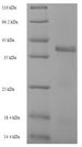 fabI Protein - (Tris-Glycine gel) Discontinuous SDS-PAGE (reduced) with 5% enrichment gel and 15% separation gel.