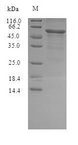 Gamma-hemolysin component C Protein - (Tris-Glycine gel) Discontinuous SDS-PAGE (reduced) with 5% enrichment gel and 15% separation gel.