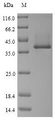 HLB Protein - (Tris-Glycine gel) Discontinuous SDS-PAGE (reduced) with 5% enrichment gel and 15% separation gel.