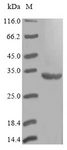 DHPS Protein - (Tris-Glycine gel) Discontinuous SDS-PAGE (reduced) with 5% enrichment gel and 15% separation gel.