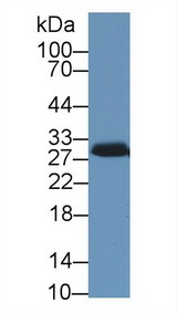 STAR Antibody - Western Blot; Sample: Porcine Adrenal gland lysate; Primary Ab: 1µg/ml Rabbit Anti-Human STAR Antibody Second Ab: 0.2µg/mL HRP-Linked Caprine Anti-Rabbit IgG Polyclonal Antibody