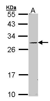 STAR Antibody - Sample (30 ug of whole cell lysate). A: Molt-4 . 12% SDS PAGE. STAR antibody diluted at 1:1000.