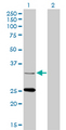 STAR Antibody - Western Blot analysis of STAR expression in transfected 293T cell line by STAR monoclonal antibody (M01), clone 5F9.Lane 1: STAR transfected lysate(31.9 KDa).Lane 2: Non-transfected lysate.