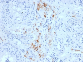 STAR Antibody - IHC staining of FFPE human testicular carcinoma with StAR antibody (clone STAR/2140). Required HIER: boil tissue sections in 10mM citrate buffer, pH 6, for 10-20 min followed by cooling at RT for 20 min.