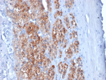 STAR Antibody - IHC staining of FFPE human testicular carcinoma with StAR antibody (clone STAR/2154). Required HIER: boil tissue sections in 10mM citrate buffer, pH 6, for 10-20 min followed by cooling at RT for 20 min.