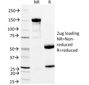 STAR Antibody - SDS-PAGE analysis of purified, BSA-free StAR antibody (clone STAR/2154) as confirmation of integrity and purity.