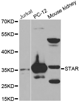 STAR Antibody - Western blot analysis of extracts of various cell lines.