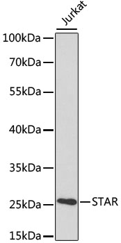 STAR Antibody - Western blot analysis of extracts of various cell lines, using STAR antibody at 1:1000 dilution. The secondary antibody used was an HRP Goat Anti-Rabbit IgG (H+L) at 1:10000 dilution. Lysates were loaded 25ug per lane and 3% nonfat dry milk in TBST was used for blocking. An ECL Kit was used for detection.