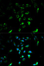 STAR Antibody - Immunofluorescence analysis of U2OS cells using STAR antibodyat dilution of 1:100. Blue: DAPI for nuclear staining.