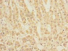 STAR Antibody - Immunohistochemistry of paraffin-embedded human adrenal gland tissue using antibody at dilution of 1:100.