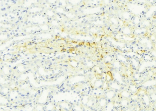 STAR Antibody - 1:100 staining mouse kidney tissue by IHC-P. The sample was formaldehyde fixed and a heat mediated antigen retrieval step in citrate buffer was performed. The sample was then blocked and incubated with the antibody for 1.5 hours at 22°C. An HRP conjugated goat anti-rabbit antibody was used as the secondary.