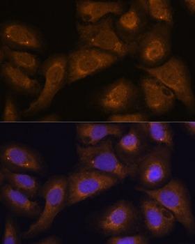 STAR Antibody - Immunofluorescence analysis of U-2OS cells using STAR Polyclonal Antibody at dilution of 1:100 (40x lens).Blue: DAPI for nuclear staining.
