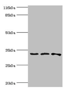 STARD10 Antibody - Western blot All lanes: STARD10 antibody at 2µg/ml Lane 1: 293T whole cell lysate Lane 2: k562 whole cell lysate Lane 3: Mouse heart tissue Secondary Goat polyclonal to rabbit IgG at 1/10000 dilution Predicted band size: 33 kDa Observed band size: 33 kDa