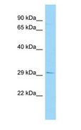 STARD10 Antibody - STARD10 antibody Western Blot of 721_B.  This image was taken for the unconjugated form of this product. Other forms have not been tested.